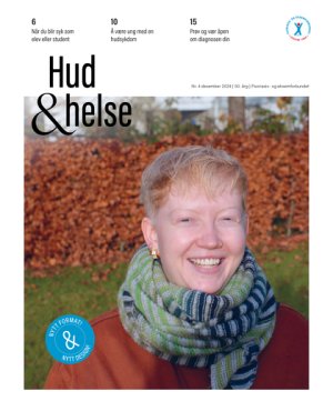 Bilde: Hud & Helse