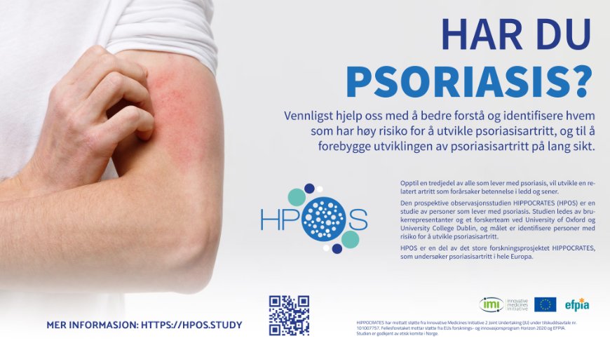 Bilde: Studie om koblingen PSO og PsA